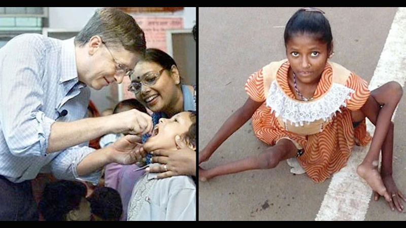 47,000 children crippled and permanently disabled in India, a direct result of Bill Gates’ Polio vaccine